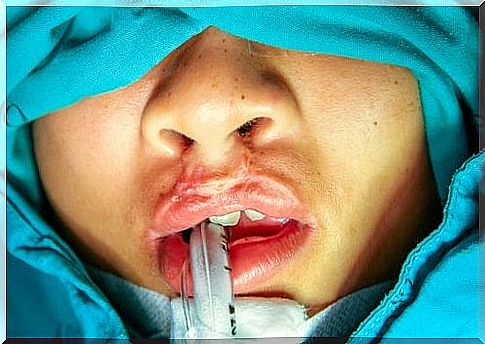 Cleft palate is not a disease.