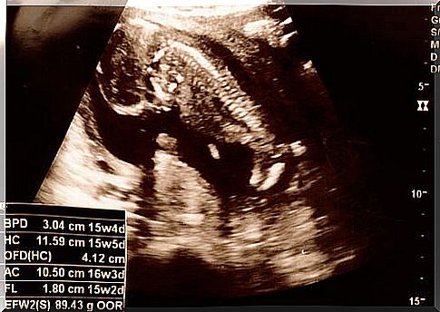 The fifteenth week ultrasound