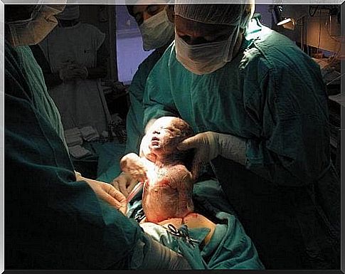 Learn about cesarean section to stay calm during childbirth.