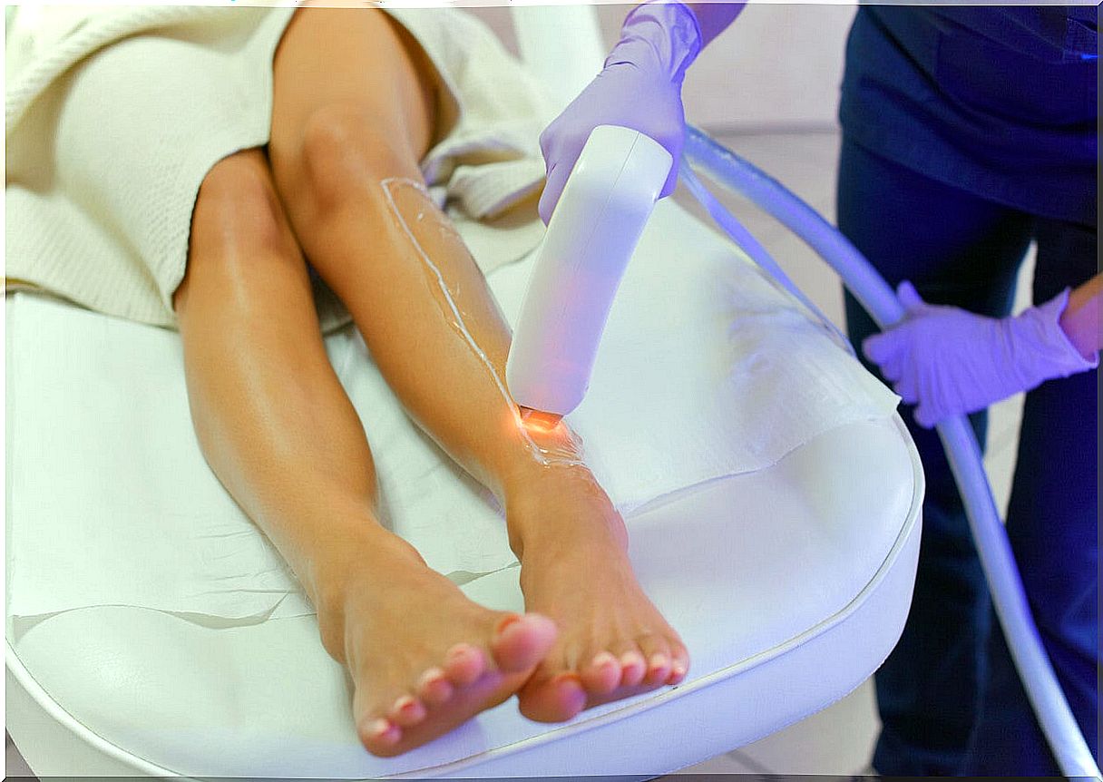 Laser hair removal on the legs.