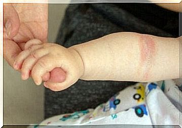 Diet and eczema in babies